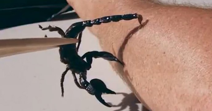 Scorpion Stings Man's Arm!
