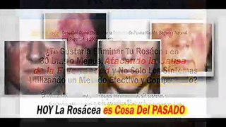 Adios Rosacea - 75% De Comision - Grandes Ventas review + bonus