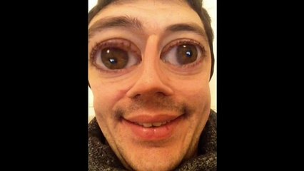 SCANDALE: Soupçons de matchs truqués chez les BREIZHILIENS. Un témoin raconte: "Ca démarre par une conversation téléphonique"