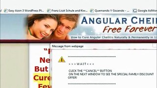 I found a Secret discount to buy Angular Cheilitis Free Forever