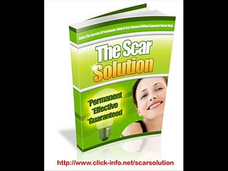 The Scar Solution - how to heal a scar fast