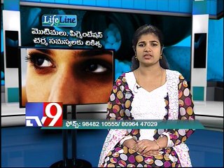 Pimples and Pigmentation treatment