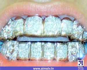 دنیا کی مہنگی ترین مسکراہٹ