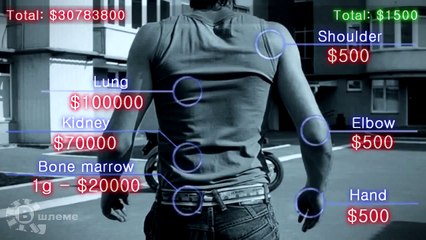 Organ Mağazasına Sahip Misiniz ? - Araba Tutkum