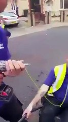 Dorel removes his teeth with drill