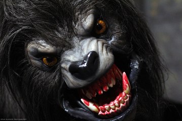 Werewolf Syndrome - Rare Medical Conditions