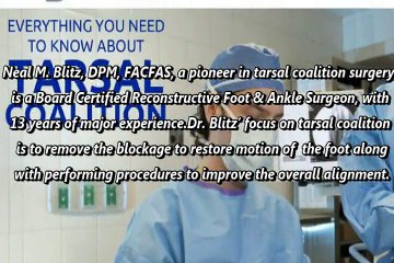 Tarsal Coalition Best Foot Doctor in New York