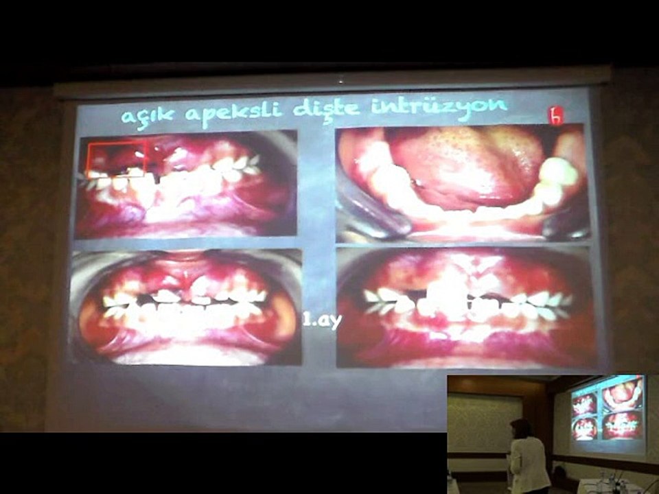 PROF.DR.AYŞE NİL ALTAY 25 EYLÜL 2014 ADO EĞİTİM SEMİNERİ 2