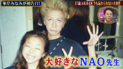 【放送事故級】AKB48　峯岸みなみ 整形画像まとめ 整形疑惑 二重だけでなく鼻やアゴも