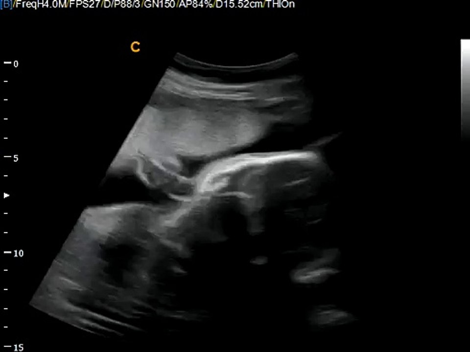 Q5-Fetal (3)-2