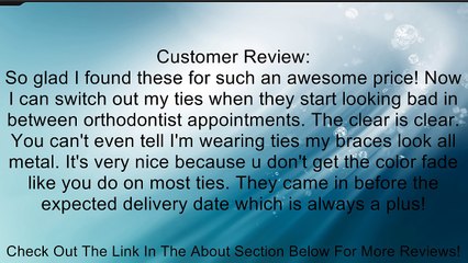 Clear -Ties- Ligature- Dental / Orthodontic - Elastic - Bands Review