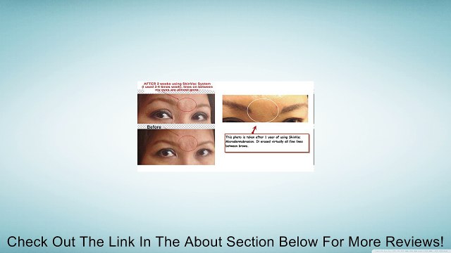 UltraRadiance: SkinVacMD Forever Diamond Microderm Tip for Face Toning, Neck Firming, Chest, & Hands use for Best Microdermabrasion (Accessory requires microderm machine and wand) Review