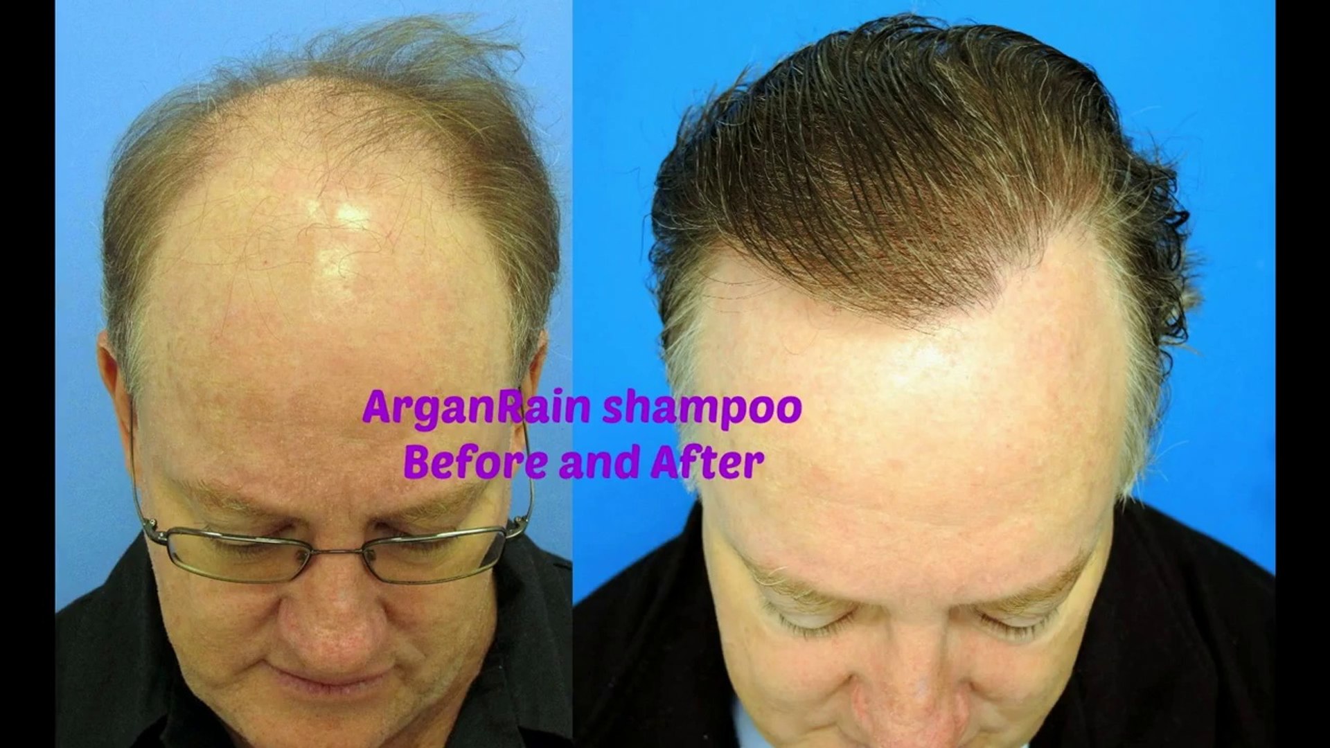 How Argan Rain Argan Oil helps to prevent hair fall? - Dailymotion Video