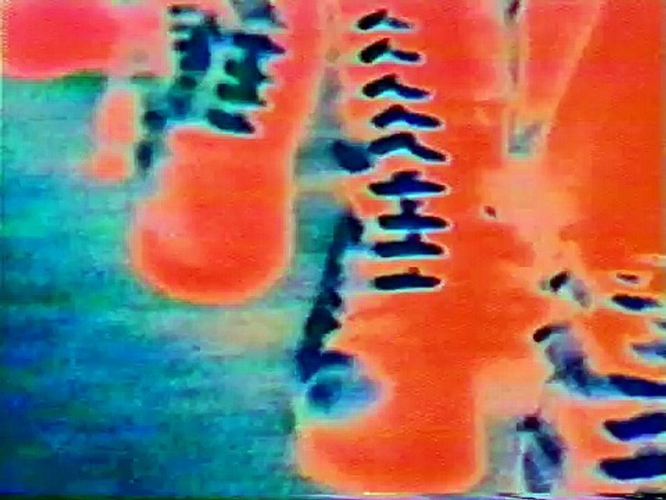 Skin Yard - 1000 Smiling Knuckles