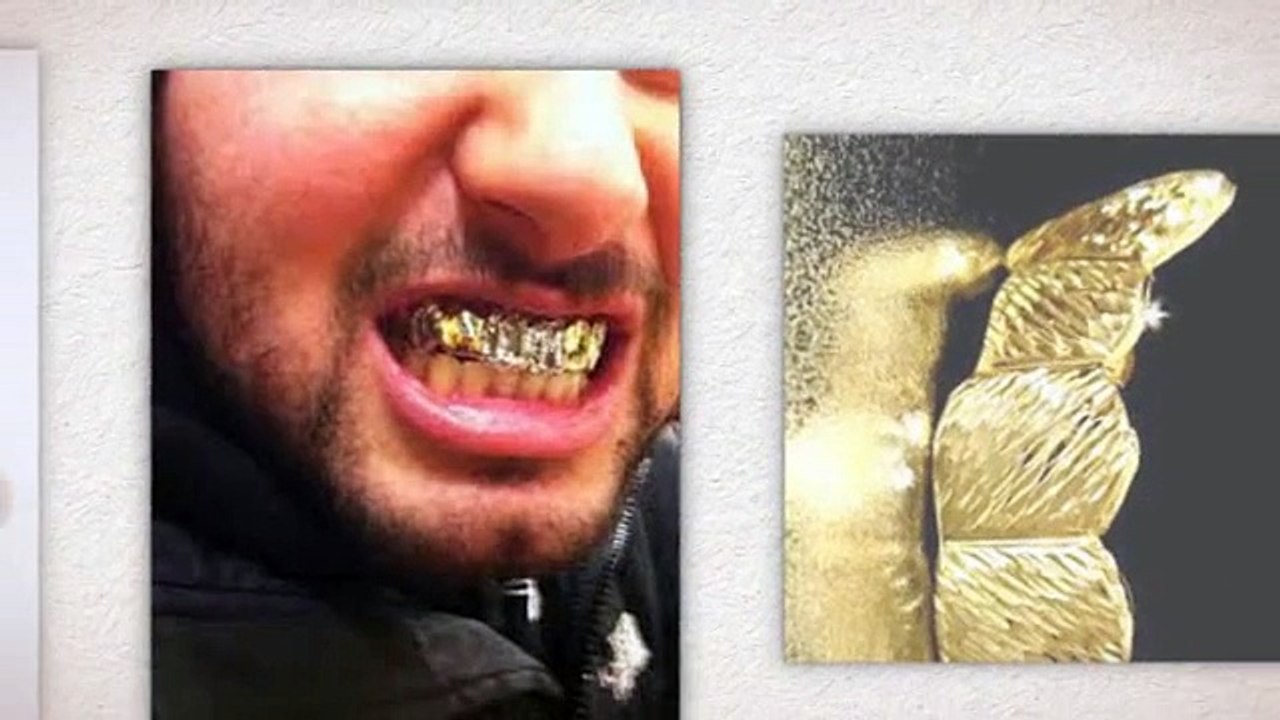 Gold Teeth Crowning