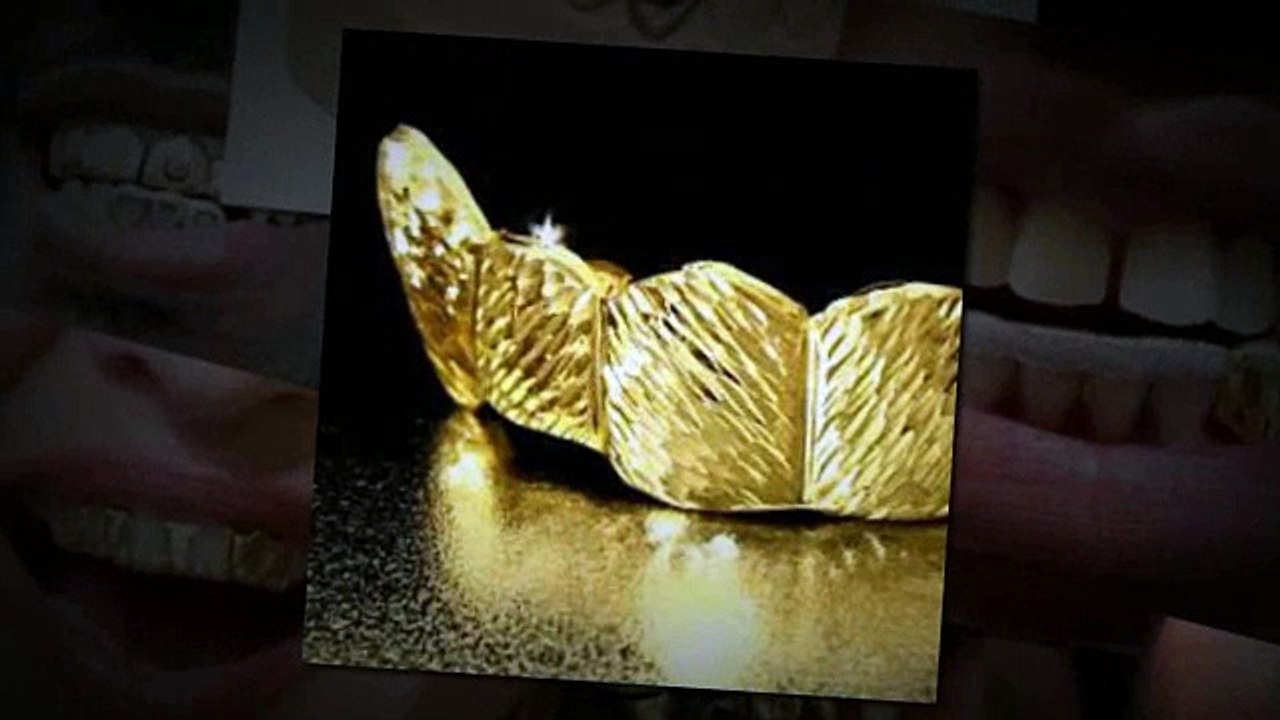 Gold Teeth Caps