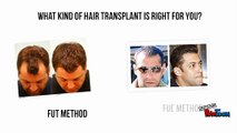 Cost For Hair Transplant In India
