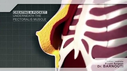 Plastic Surgery and Breast Augmentation