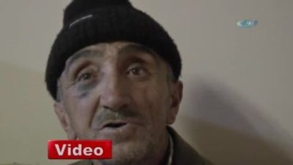 Bedelli Parası Vermeyen Babasını Dövdü