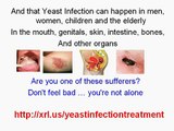 easy way to cure yeast infection - buy yeast infection no more book