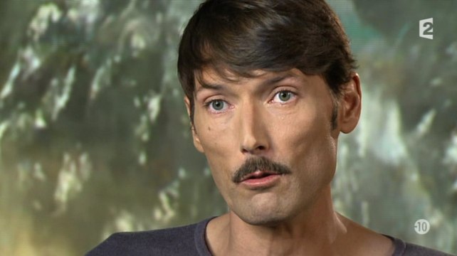 Laurent Kérusoré (PBLV) raconte son agression - ZAPPING PEOPLE DU 10/12/2014