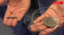 Le CHU de Rennes expérimente un pacemaker miniature qui va révolutionner la chirurgie cardiaque