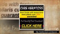Keratosis Pilaris Treatment Coconut Oil  Keratosis Pilaris Cure Treatment - Living With Kp Review