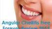 Angular Cheilitis Free Forever Review  Healthfinessreview