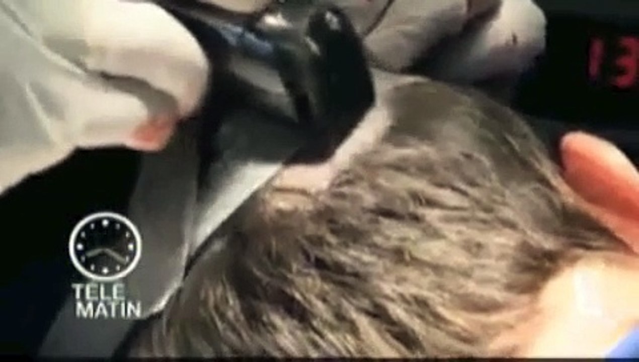 Implants capillaires Bien etre Sante Telematin Emission