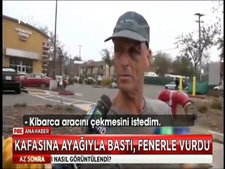 Amerikan Polisi çoştu şiddette engel tanımıyor