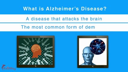 Alzheimer's Disease Prevention and Treatment | PlacidWay