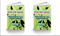 best acne skin care treatment - Clear Skin Forever