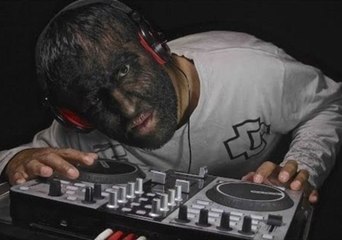 The Life Behind Being Called 'Werewolf'