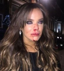 Güzel Oyuncu Maria Fowler Gece Saldırıya Uğradı