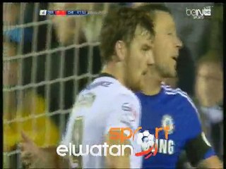 اصابه زوما لاعب تشيلسى