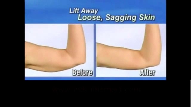 Lift Kol Sarkmalarına Karşı Gizleyici Bant indirimsmart.com