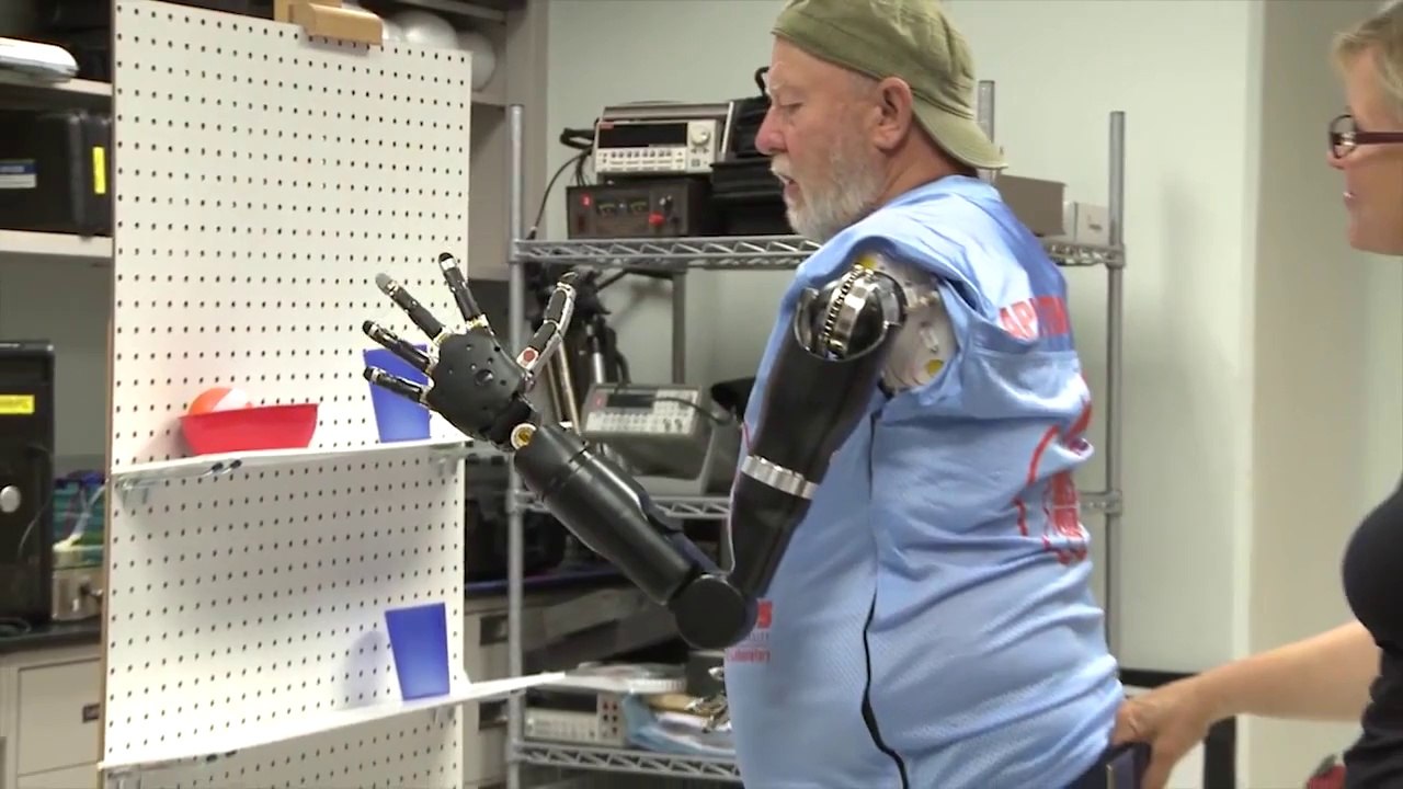 Amputee try APL’s Modular Prosthetic Limb