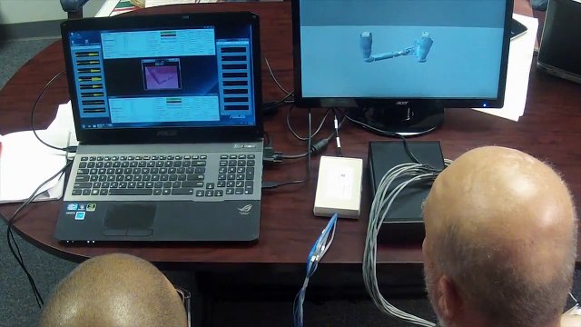 Un homme amputé des deux bras teste des prothèses robotiques