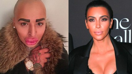 Il dépense une fortune pour ressembler à Kim Kardashian