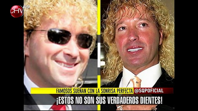Mira los verdaderos dientes de algunos famosos - SQP