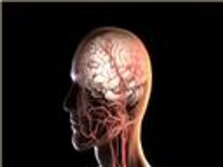 دراسة: أجهزة إزالة الجلطات الدموية أفضل لصحة المريض