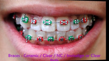 Dr.Shravan's SHINE 'N' SMILE, Dental Clinic in Attapur, Hyderabad
