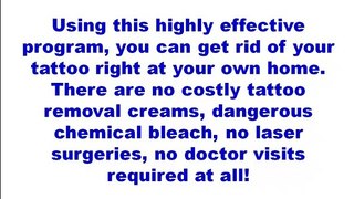 get rid of your tattoo at home - Get Rid Tattoo