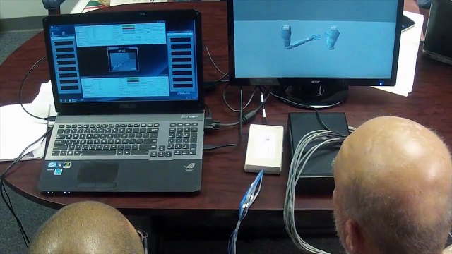 Un amputé utilise des bras robots