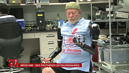 Des bras articulés dirigés par la pensée