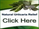 urticaria treatment Natural Urticaria Relief Pdf   How To Cure Chronic Urticaria