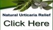 urticaria treatment Natural Urticaria Relief Pdf + How To Cure Chronic Urticaria