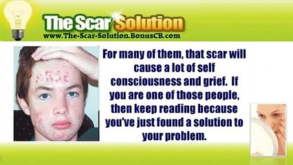 The Scar Solution - Learn the Secret of Permanent Natural Scar Removal