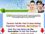 Natural Vitiligo Treatment System Pdf + DISCOUNT + BONUS