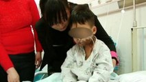 Toddler suffers horrific burns after drinking sulfuric acid